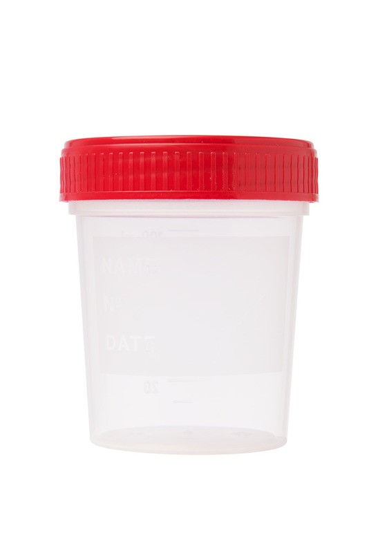 Probenbecher, steril mit Deckel Rot, 120 ml - 300 Stk.