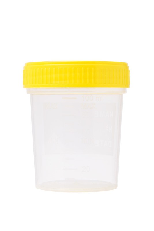 Probenbecher, steril mit Deckel Gelb, 120 ml - 300 Stk.