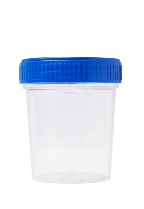 Probenbecher, steril mit Deckel Blau, 120 ml - 300 Stk.